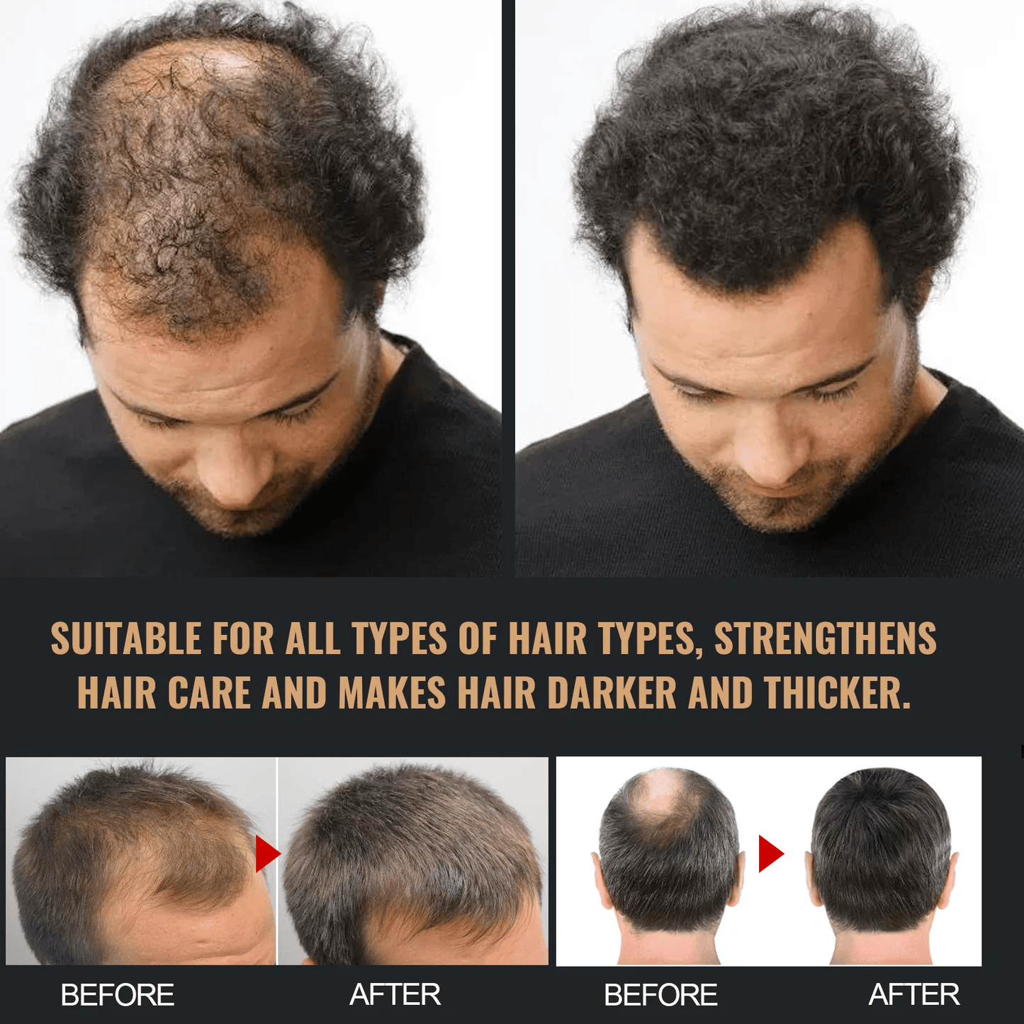 SPARTAN Root Activator Shampoo - Increased Hair Growth with Just 4 Washes a Week* - Nilola