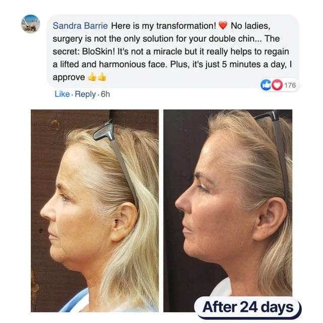 Lifting Face Mask - Hot Sale 50% Off
