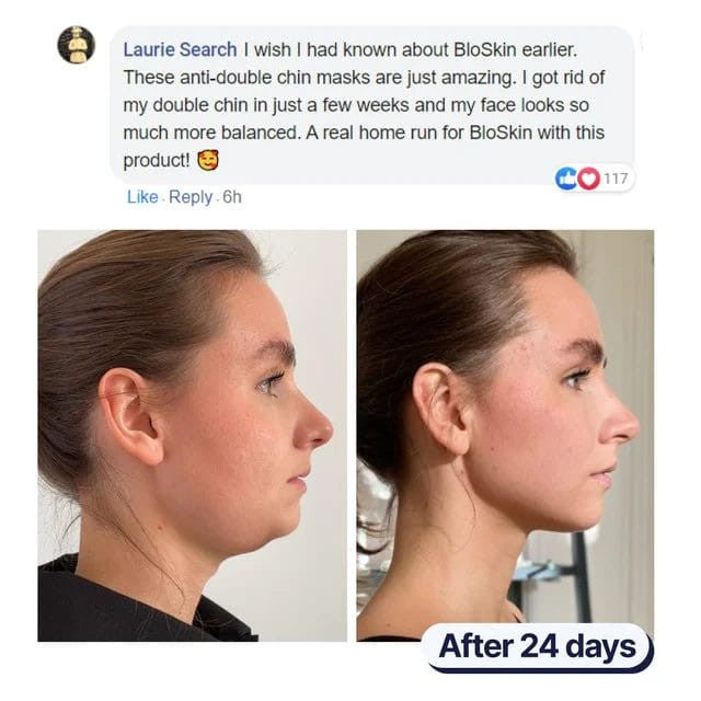 Lifting Face Mask - Hot Sale 50% Off