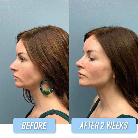 Lifting Face Mask - Hot Sale 50% Off